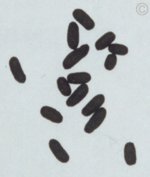 Chinchilla Examination - Droppings from a healthy chinchilla. 